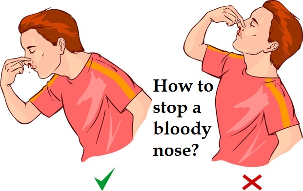 how-to-stop-a-bloody-nose