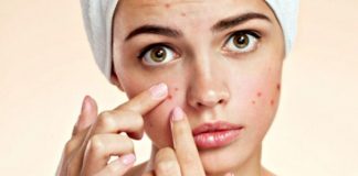 Home Remedies for Pimples