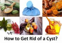 how to get rid of a cyst