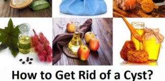 how to get rid of a cyst