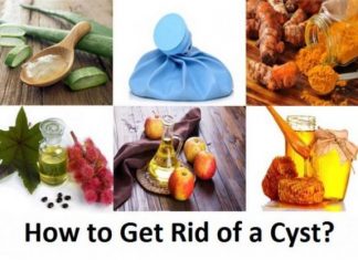 how to get rid of a cyst