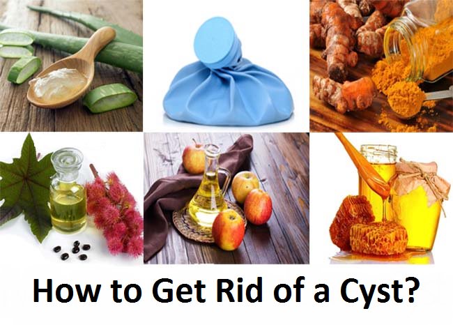 how to get rid of a cyst