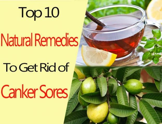 how to get rid of a canker sore quickly