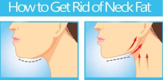 how to get rid of neck fat