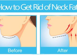 how to get rid of neck fat