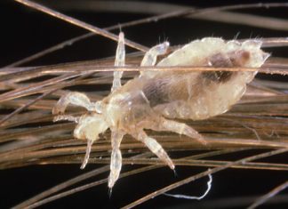 tea tree oil for lice