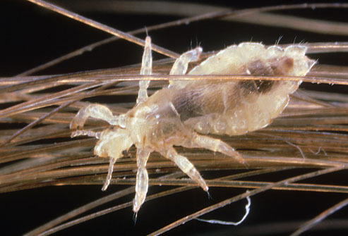 tea tree oil for lice