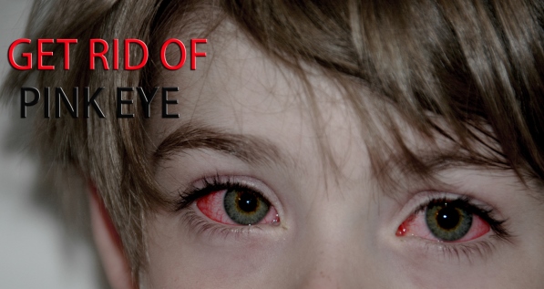 Get Rid of Pink Eye