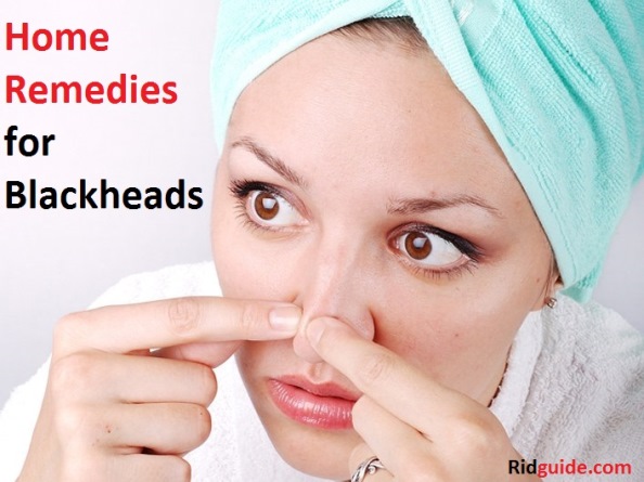 Home Remedies for Blackheads