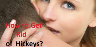 How to Get Rid of Hickeys