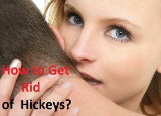 How to Get Rid of Hickeys