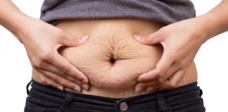 How to Get Rid of Stretch Marks