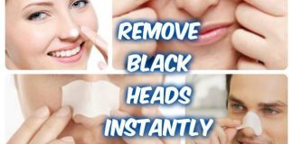 how to get rid of blackheads on nose