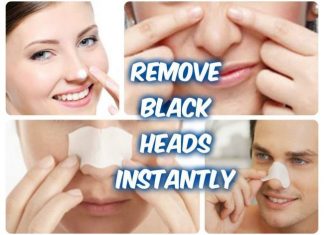 how to get rid of blackheads on nose