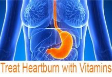 how to get rid of heartburn