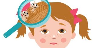 how to get rid of lice