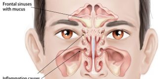 how to relieve sinus pressure