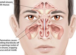 how to relieve sinus pressure