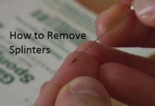 How to Remove Splinters?