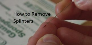 How to Remove Splinters?