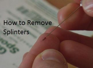 How to Remove Splinters?