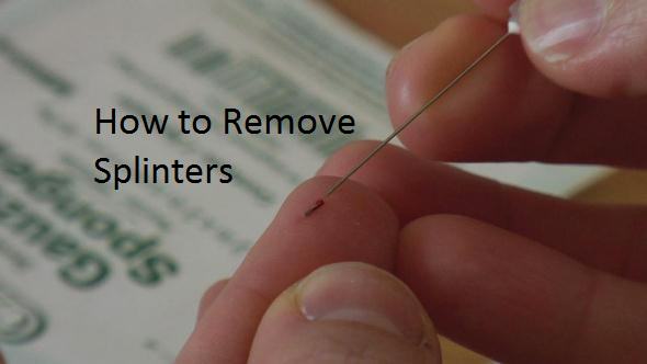 How to Remove Splinters?