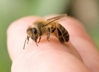 how to treat a bee sting