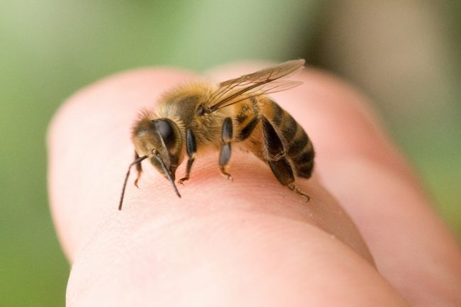 how to treat a bee sting