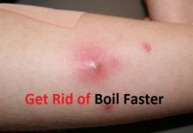 how to get rid of a boil