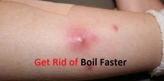 how to get rid of a boil