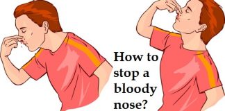 How to Stop a Bloody Nose