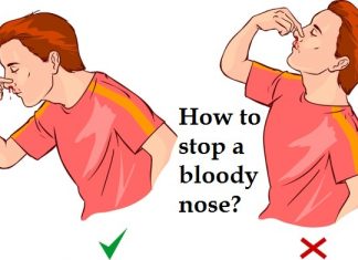 How to Stop a Bloody Nose