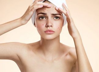 get rid of pimple a pimple fast