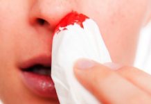 how to stop nose bleeding