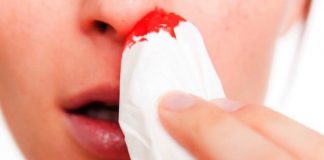 how to stop nose bleeding