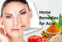 home remedies for acne