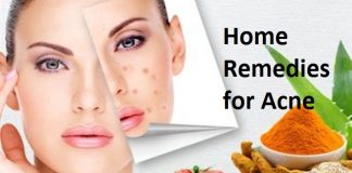 home remedies for acne