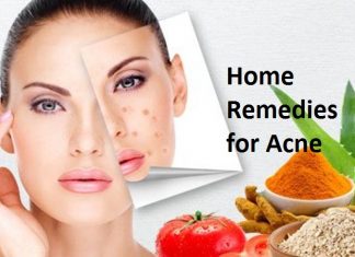 home remedies for acne