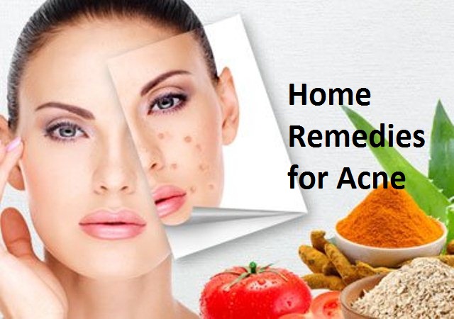 home remedies for acne