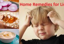 home remedies for lice