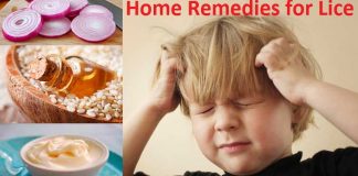 home remedies for lice