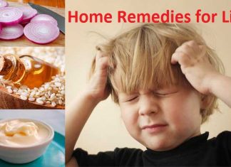 home remedies for lice