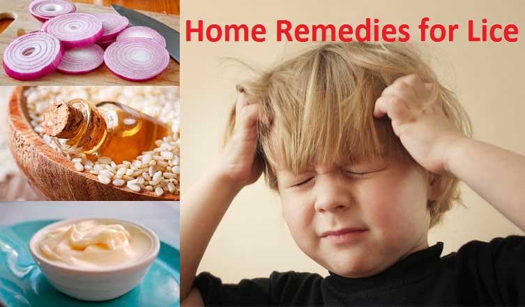 home remedies for lice