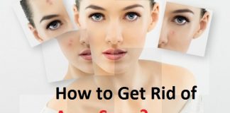 how to get rid of acne scars