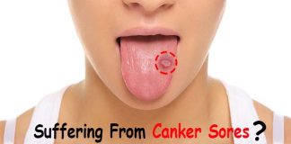 how to get rid of canker sores