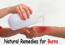 how to treat a burn