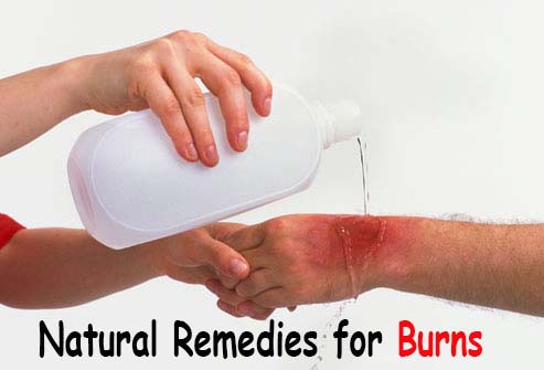 how to treat a burn