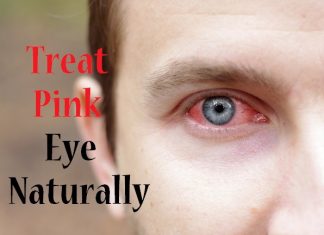 how to treat pink eye