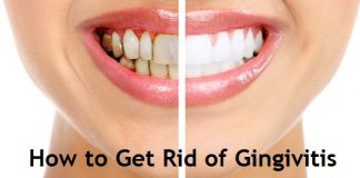 how to get rid of gingivitis