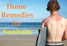 Home remedies for sunburn